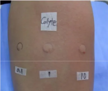 Figure 1. Intradermal tests with different concentrations of diluted Colyte ® solutions