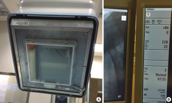 Fig. 4. An example dose report from a three phase liver CT performed on a GE Dis- Dis-covery CT750HD CT machine