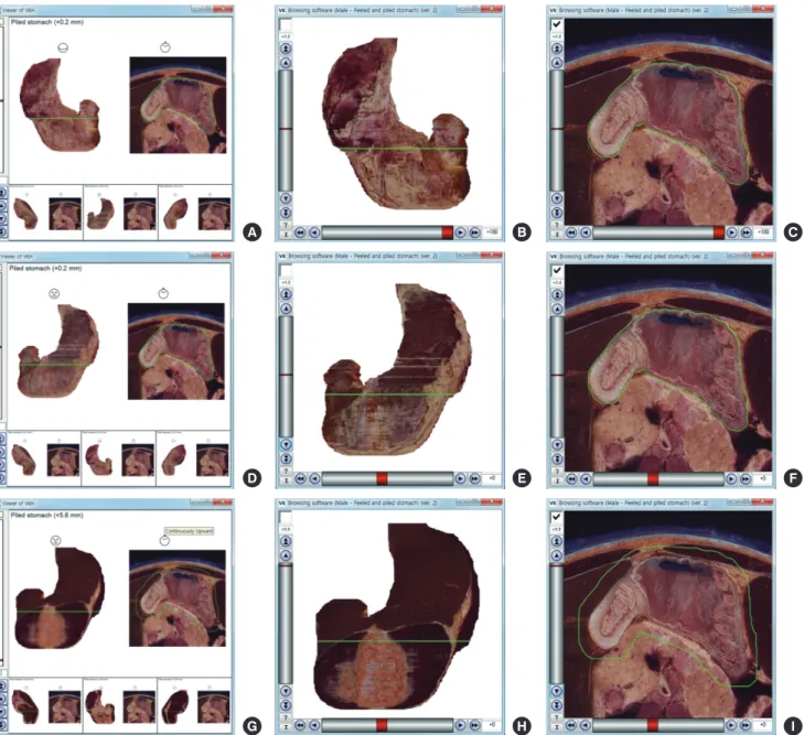 Fig. 3. Comparison of previous and new software that show the volume models and sectioned images of stomach