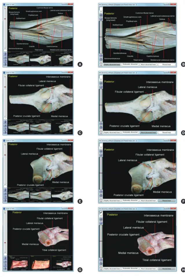 Fig. 4. Comparison of previous and new software that show cadaveric knees. (A, B) Slightly dissected knee of embalmed cadaver