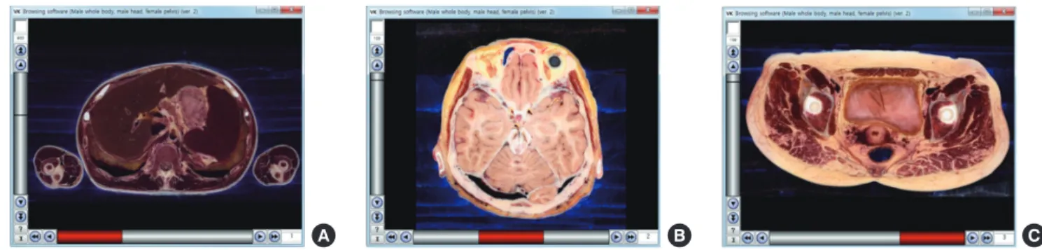 Fig. 5. Experimental software to show the sectioned images of 3 cadavers with the x-axis scroll bar