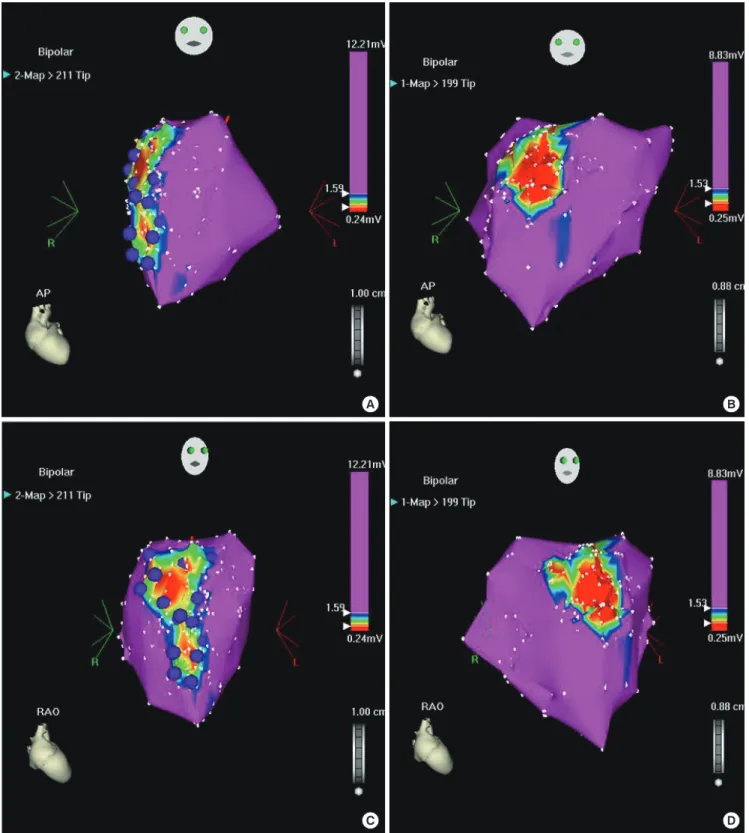 Fig. 1. Comparisons of infarct size by visual estimation between 1 week and 4 weeks post-AMI in cell injected pig (purple dots)