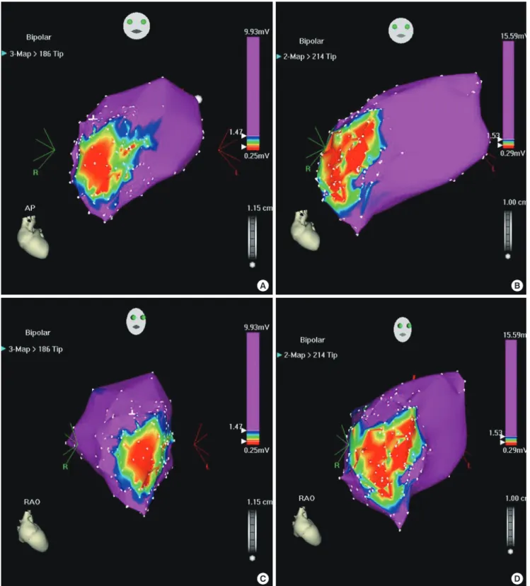 Fig. 2. Comparisons of infarct size by visual estimation between 1 week and 4 weeks post-AMI in control pig