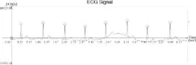 Fig. 4 R peak detection from ECG signal
