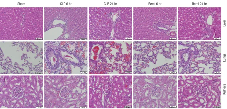 Fig. 4. H &amp; E stained sections of liver, lungs and kidneys from rats subjected to sham/CLP operation 6 hours and 24 hours after surgery