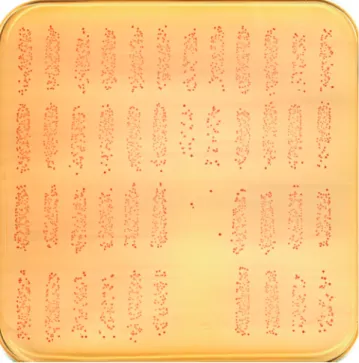Fig. 1. Microcolonies of serotype III GBS on a THYA-NR plate (Todd-Hewitt agar with  yeast extract containing neutral red and Tris solution) after overnight incubation (37°C/ 