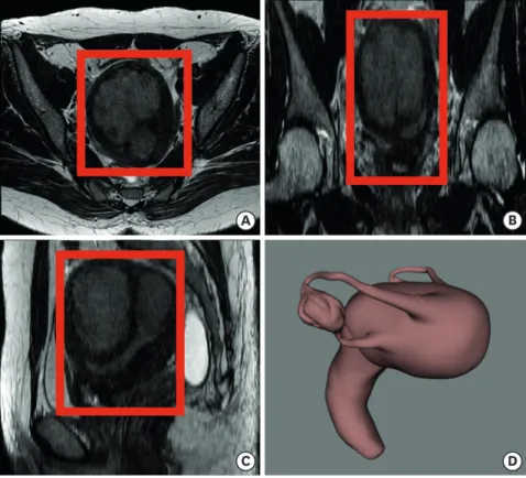 Fig. 2. Maximum area of a uterus on each plane of 2D MRI. (A) Axial plane. (B) Sagittal plane