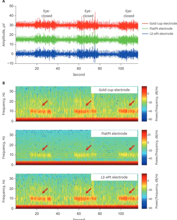 Fig. 5. Raw EEG signals and spectrograms during alpha rhythm recording sessions. (A) Raw EEGs during eye-open and closed sessions