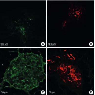 Fig. 2. CTB-AF injection sites observed via a confocal microscope. (A) Intense green-fluorescence is observed in  the LAA injection site (× 100)