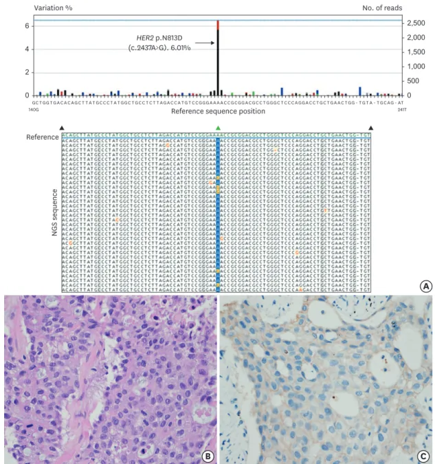 Fig. 2. Pathologic and molecular diagnosis for lung adenocarcinoma harboring HER2 mutation