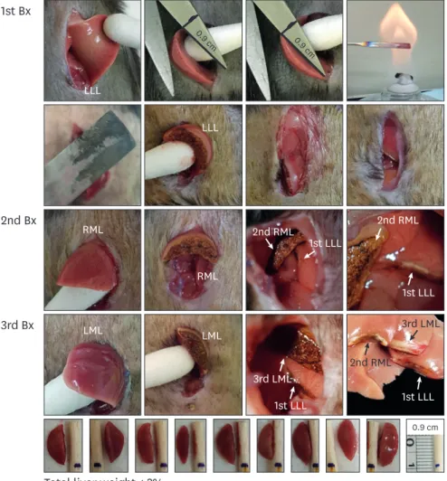 Fig. 1. Multiple liver Bx procedure. 