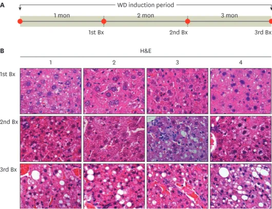 Fig. 4. Tracing disease progression using repeated liver Bx. (A) Timing of multiple liver biopsies