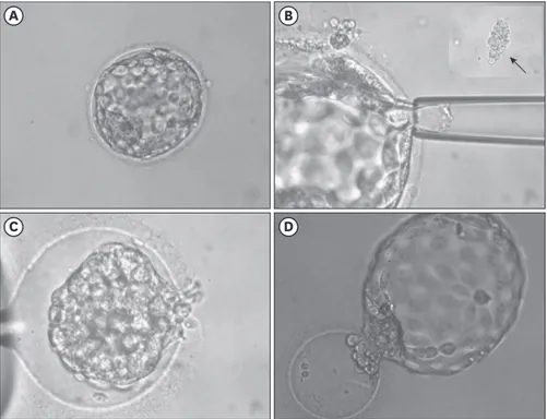Fig. 2. The process of blastocyst biopsy. (A) Expanded blastocyst (magnification ×200)