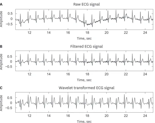 Fig. 2. Preprocessing of the short-term normal ECG signal. (A) raw ECG signal, (B) filtered ECG signal, and (C)  wavelet transformed ECG signal