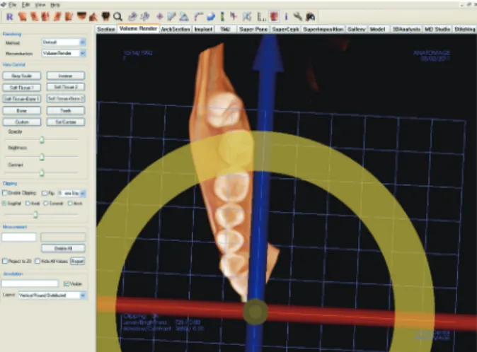 Fig. 3. Sagittal view (y-z plane). The left part of the  image was cut off in program to measure the right part.