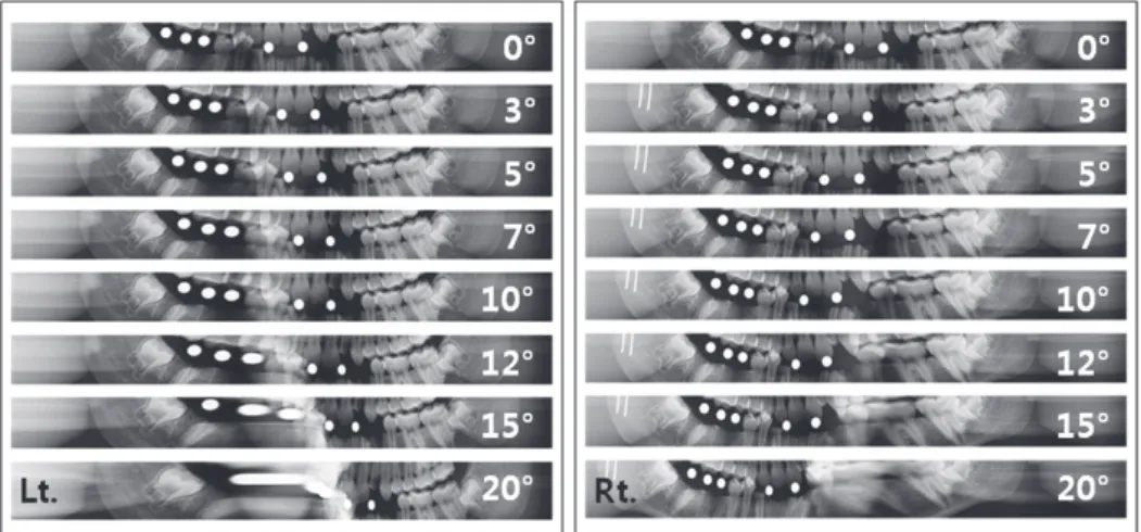Fig. 5. Panoramic images according to the left and the right rotations.