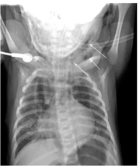 Fig. 1. Three dimensional neck CT. 