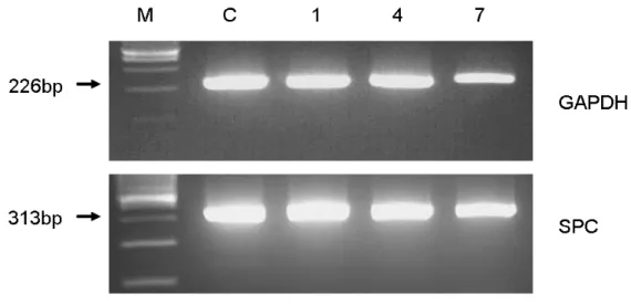 Fig. 2. RT-PCR of SPC mRNA extracted from cells cultured in SAGM. Lane M,  100-bp ladder molecular size marker; lane C, control (A549 cell); lanes 1, 4, 7,  Cells from sample Nos