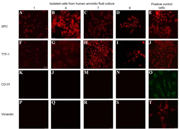 Fig. 3. Immunofluorescence staining. Isolated cells from different human amniotic fluid  culture (sample Nos