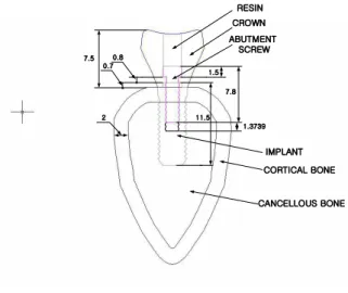 Fig. 2. Three-dimensional finite element in model.