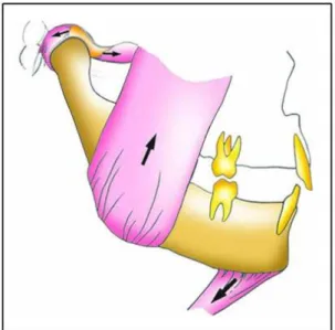 Fig. 6. Vertical Dimension 은 치아간 거리 근안정 , 위 압박 받지 않는 측두악관절강에 의해 형성 , 육계의 해부학적 변화를 야기한다 실제로 장기간.치아상실을 경험하였거나 기존 보철물에서 이미 수직고경이 감소되어 있었다면 교합시 근육이 과수,축되어 거상근의 안정위를 파괴되고 근피료와 근막동통을 야기한다.이러한 근변화에 따라 외측익돌근이 수축되어 관절원판은 전방으로 전위되고 과두는 관절원판후조직을 후상방으로 압박하여 근증상과 더불어 측