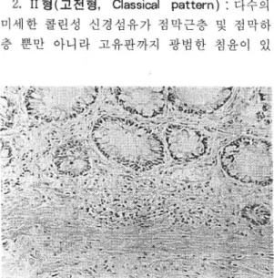 Fig.  2.  Pattern  I  (newborn  pattern).  Thick  ACHE  positive  cholinergic  fibers  distribute  diffusely  in  the  muscularis  mucosae  and  submucosa,  but  the  lamina  propria  is  clear
