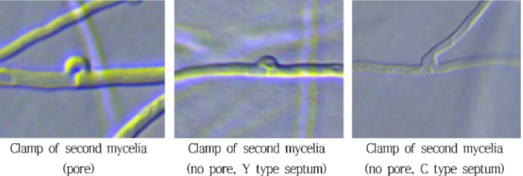 Fig. 14. The growth forms of mycelia in clamp using inverted microscope (400x).