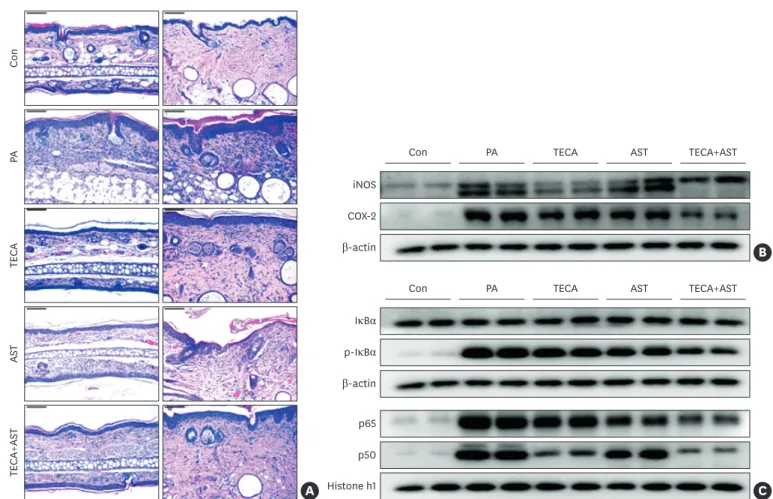 Fig. 2. Histopathological analysis of dorsal ear and back skin tissues and the anti-inflammatory effects of the TECA + AST treatment through inhibiting NF-κB  in the back skin