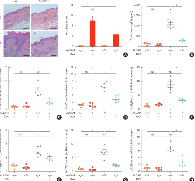 Fig. 3. ALCAM deficiency attenuates T helper-dominant skin inflammation induced by epicutaneous OVA sensitization
