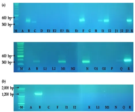 Figure  2. PCR detection of B. cereus and cereulide-producing B. cereus (a) B. cereus and (b) cereulide producing B