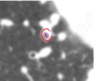 Fig. 2. Abdominal fat area assessed via CT in a 44-year-old man. The fat area was marked green