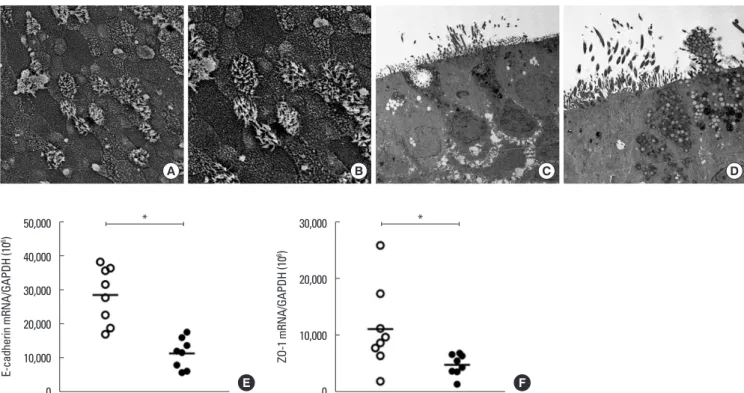 Fig. 5. Scanning electron microscopic (SEM) and transmission electron microscopic (TEM) findings of cultured ARNE cells at 14 days after confluence