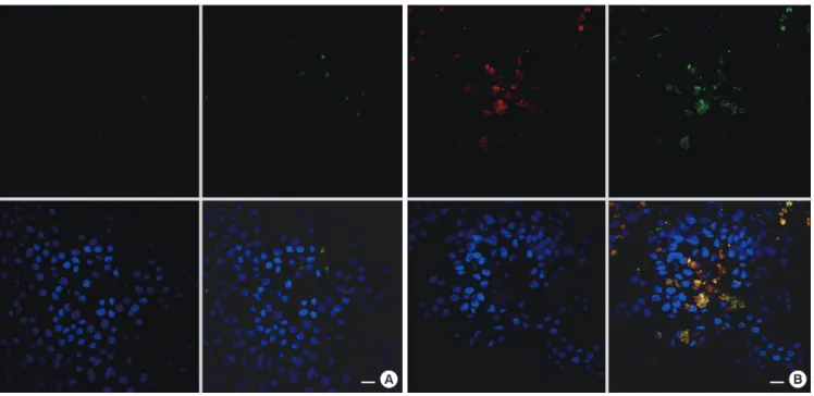 Fig. 4. Expression of TMEM16A in non-ciliated cells. Confocal microscopy xy images of ALI-cultured HNPECs without IL-13 (A) and with IL-13 (10 ng/mL, 14 days) (B)  showing immunoreactivity for TMEM16A (red) and acetylated-tubulin (green)