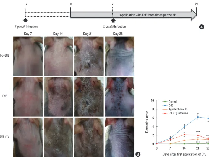 Fig. 1. T. gondii infection inhibits atopic dermatitis in NC/Nga mice. (A) Experimental schedule for the development of DfE-induced atopic dermatitis and T