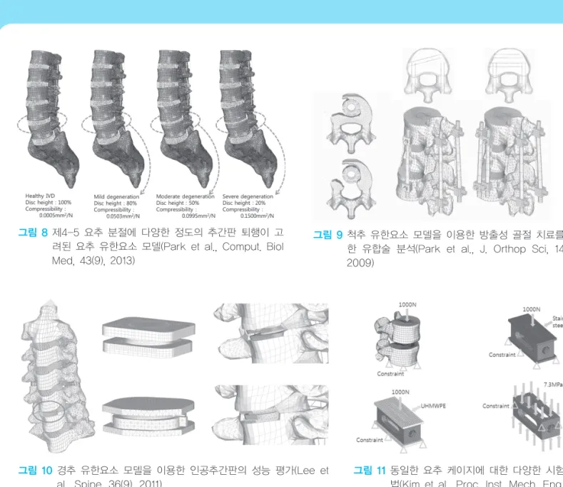 그림 11 동일한 요추 케이지에 대한 다양한 시험 방 법(Kim et al., Proc. Inst. Mech. Eng. H, 226(4), 2012)