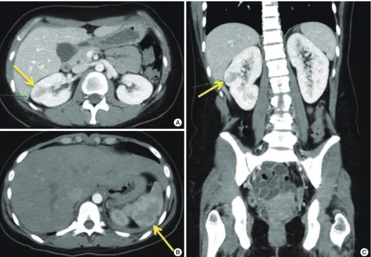Fig. 3. Disseminated intravascular coagulation profiles according to the patient  progress
