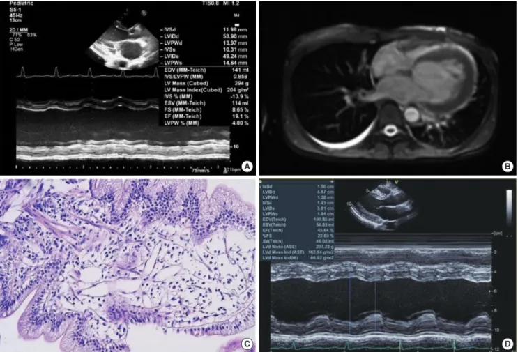 Fig. 3. Time changes in the blood eosinophilia, ejection fraction, B-type natri- natri-uretic peptide and degree of dyspnea during treatment