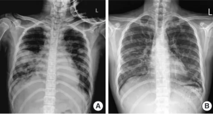 Fig. 5. Hospital course of case 2 at 1st admission.