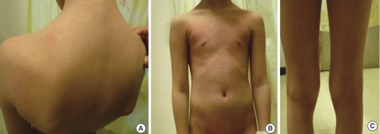 Fig. 1. Maculopapular rash on neck, back (A), chest, abdomen (B), and extremities (C) at the initial visit.