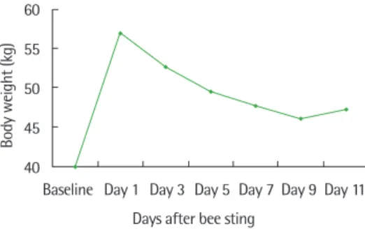Fig. 2. Body weight change before and post-bee sting. Baseline body weight is  40 kg. After bee sting, the weight is peak up to 57 kg at day 1