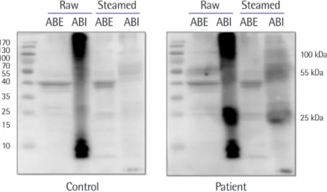 Fig. 3. IgE immunoblotting of the abalone protein with sera of patients and  healthy control