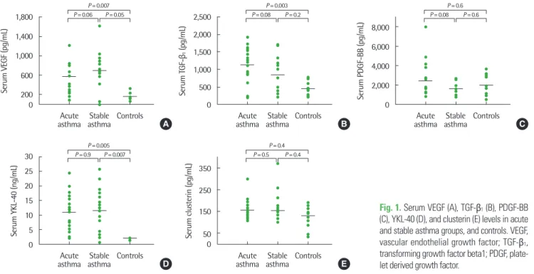 Fig. 1. Serum VEGF (A), TGF-β 1  (B), PDGF-BB  (C), YKL-40 (D), and clusterin (E) levels in acute  and stable asthma groups, and controls