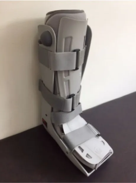 Fig. 2. Functional brace after the removal of splint.