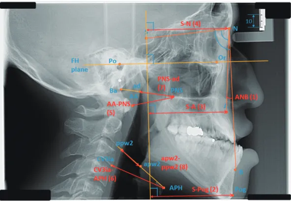 Table 1. The angle and distance measurements of the skull