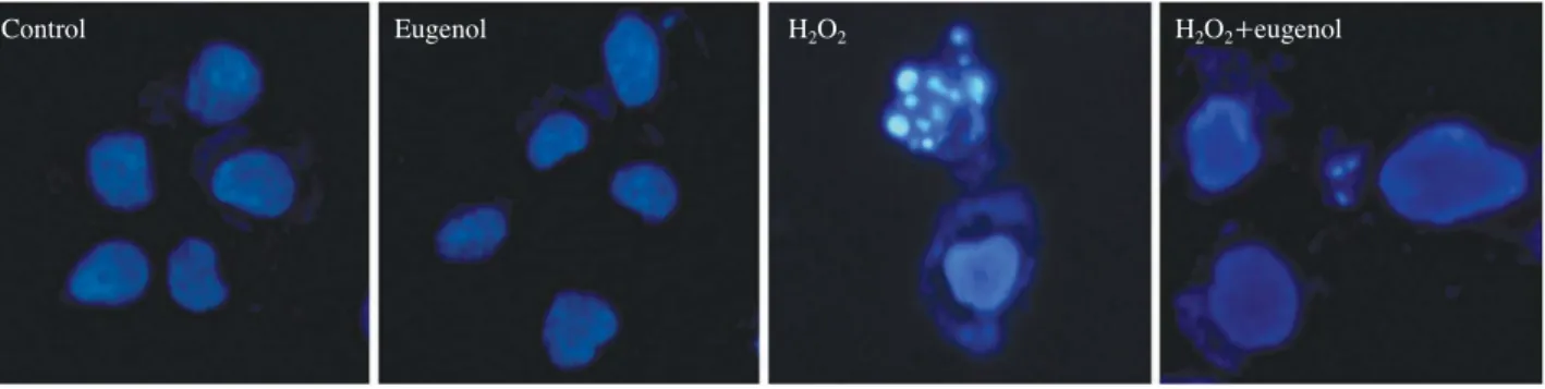 Fig. 4. Nucleus condensation signally was observed on PDLF cells stimulated with H 2 O 2 
