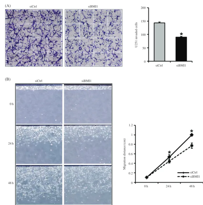 Fig. 4.  Effect of BMI1 knockdown on cell invasion and migration in U251 cells. (A) Invasive cells in the cell invasion assay were stained  and counted