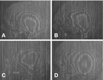 Fig. 4. From the lateral view. (A) Comma, (B) Auricular, (C) Arrowhead, (D) Ellipsoid.