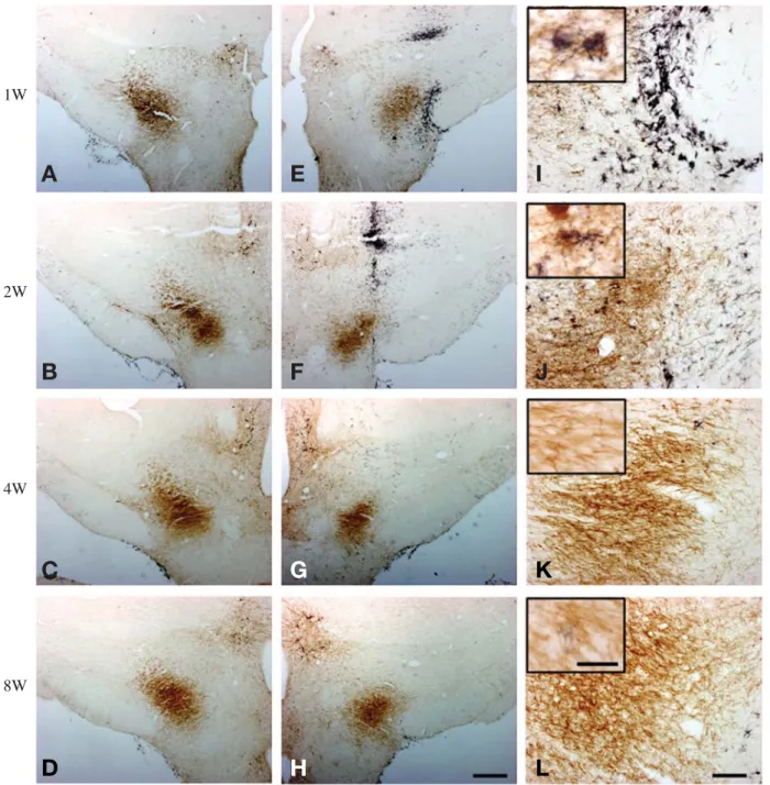 Fig. 1. Double immunohistochemistry of TH (brown) and OX6 (black) in coronal sections passing through the MFB middle to the lesioned site