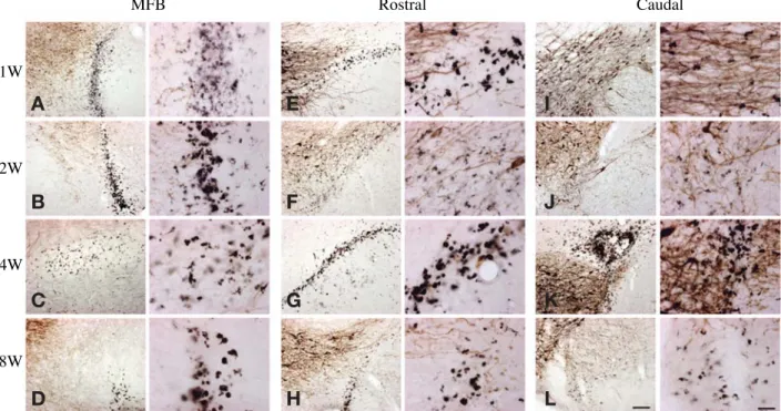 Fig. 4. Double immunohistochemistry of TH (brown) and ED1 (black) in the ipsilateral MFB or SN