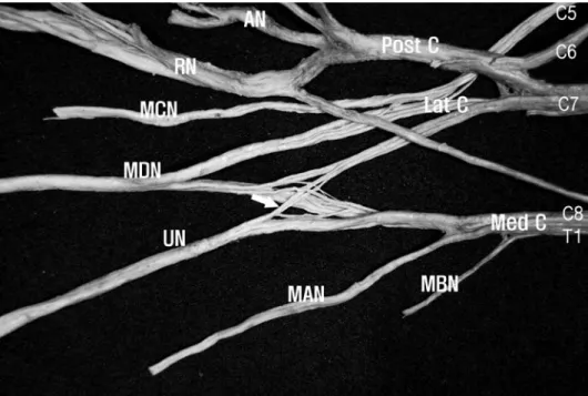 Table 1. Numbers of myelinated axons of C7, C8 and T1 roots participating to the ulnar nerve.
